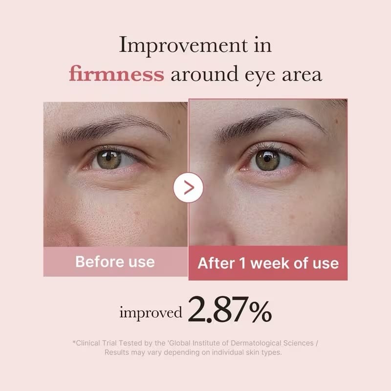Medicube PDRN Pink Peptide Eye Cream - Imagen 3